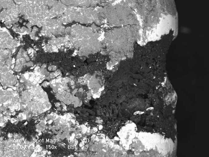 Diffuse fractures on rings produced by gas pipe